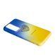 Чехол Case UA для Xiaomi 12T Pro Heart 090935 фото 2