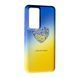 Чехол Case UA для Xiaomi 12T Pro Heart 090935 фото 1
